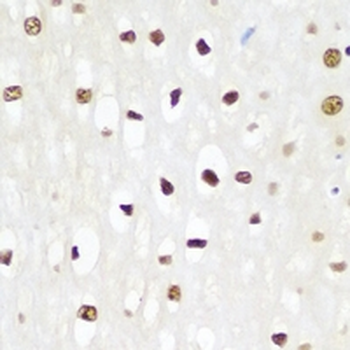 p62 Antibody