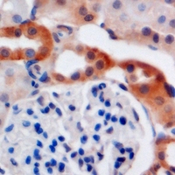 C4BP beta Antibody