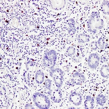 Anti-TPSAB1 Antibody