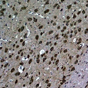 Anti-LC3B Antibody