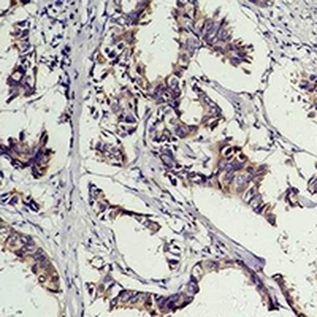 Anti-Phosphotyrosine Antibody