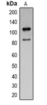 Anti-Cleaved PARP1 Antibody