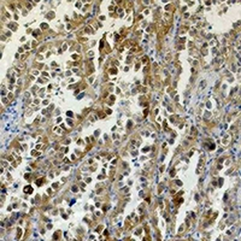 Anti-Carbonic Anhydrase 9 Antibody Antibody