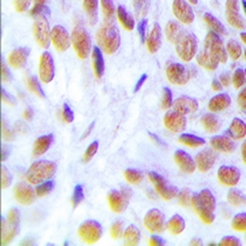 Anti-Glucocorticoid Receptor Antibody