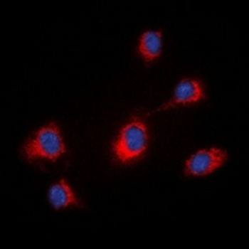 Anti-MID1 Antibody