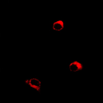 Anti-Orexin Receptor 1 Antibody