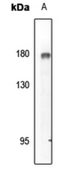 Anti-EGFR (pY869) Antibody