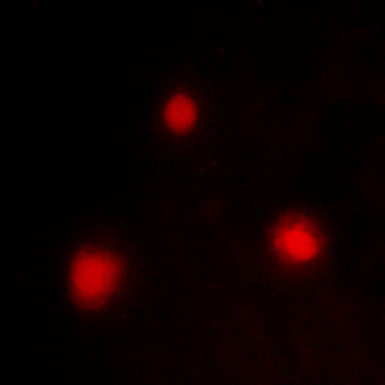 Anti-FOXH1 Antibody