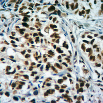 Anti-Histone H3 (TriMethyl-K4) Antibody