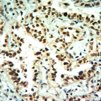 Anti-Histone H3 (MonoMethyl-K4) Antibody