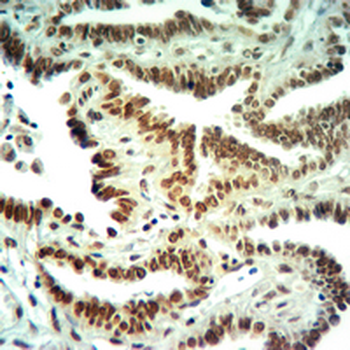 Anti-Histone H3 (DiMethyl-K36) Antibody