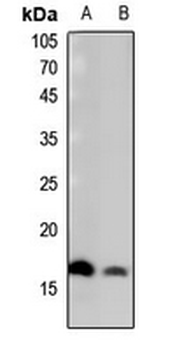 Histone H2B (Butyryl-K15) Antibody
