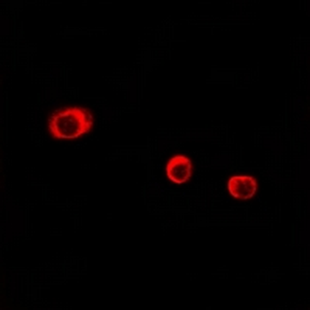Anti-CD363 Antibody