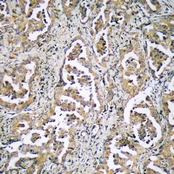 Anti-ADAMTS17 Antibody