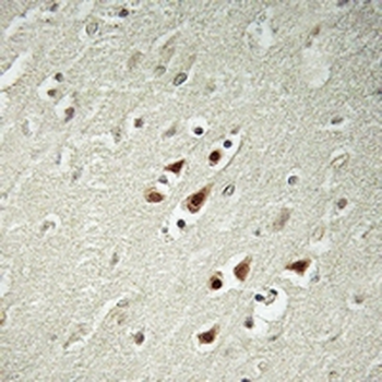 Anti-ABHD14B Antibody