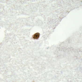 Anti-DGK zeta Antibody