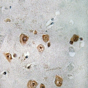 Anti-NCOA3 Antibody