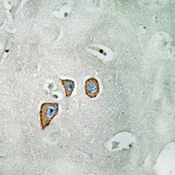 Anti-NMDAR2C Antibody