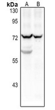 Anti-CD125 Antibody