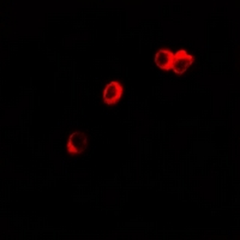 Anti-GPR150 Antibody