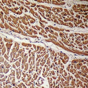 Anti-Podocan Antibody