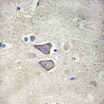 Anti-Cadherin 9 Antibody