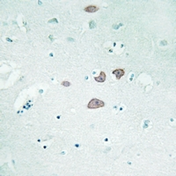 Anti-STON1 Antibody