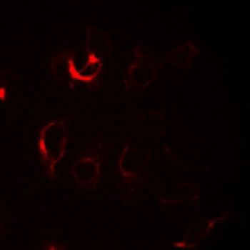 Anti-ILKAP Antibody