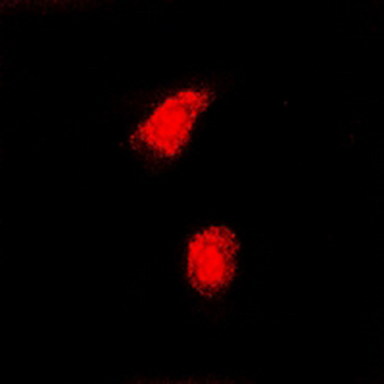 Anti-CAF-I p60 Antibody