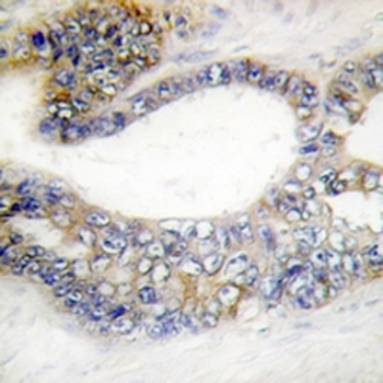 Anti-DCR3 Antibody