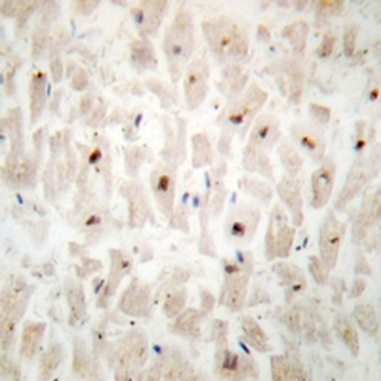 Anti-ST18 Antibody