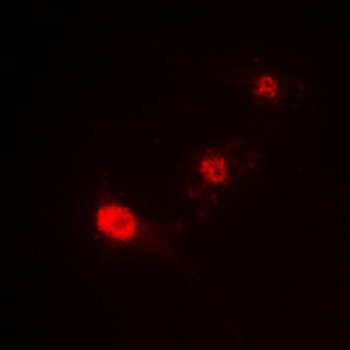 Anti-ST18 Antibody
