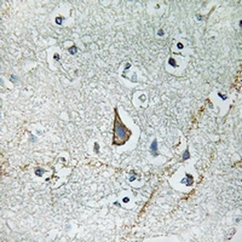 Anti-GNAZ Antibody