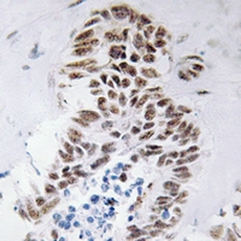 Anti-DAP Kinase 3 Antibody