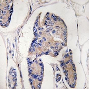 Anti-ULK1 Antibody