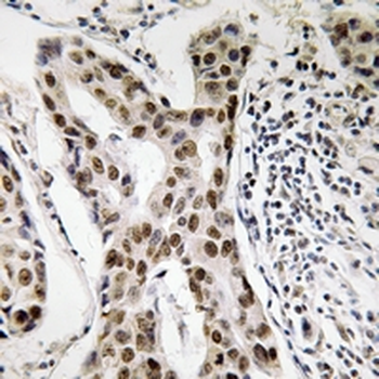 Anti-PMS2 Antibody