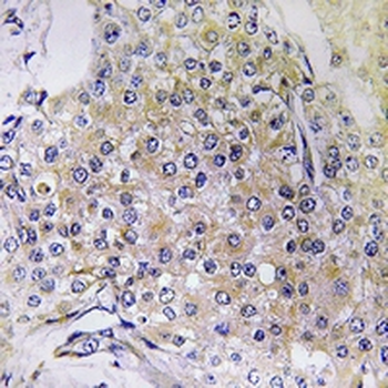 Anti-NDUFS6 Antibody