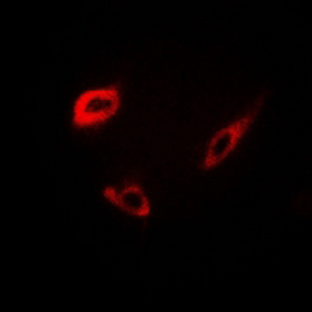 Anti-INSL4 Antibody