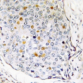 Anti-RPS27L Antibody