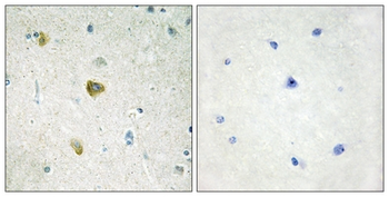 Anti-NDUFC2 Antibody