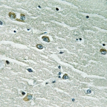 Anti-MERTK/TYRO3 Antibody