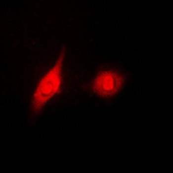 Anti-ERK1/2 (pY204) Antibody