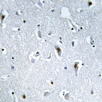 Anti-HMGN2 (pS29) Antibody
