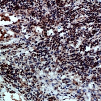 Anti-CD47 Antibody