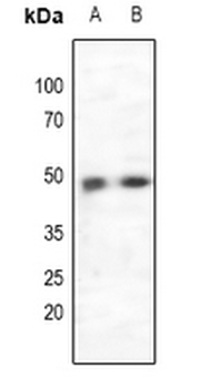 Anti-CCR5 Antibody