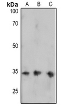 Anti-FOSB (pS27) Antibody