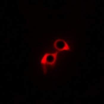 Anti-GPR169 Antibody