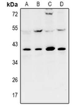 Anti-KPC2 Antibody