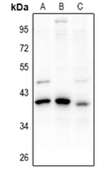 Anti-PDIK1L Antibody