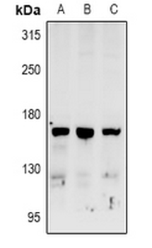 Anti-RAB3GAP2 Antibody